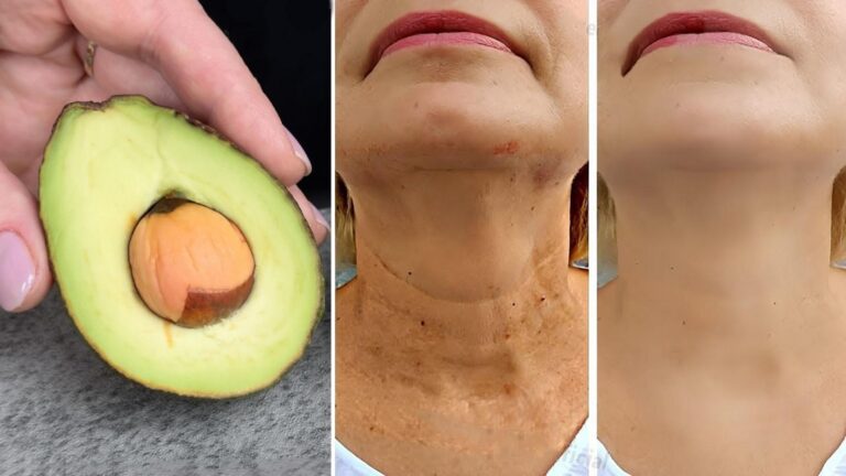 7 magicznych maseczek, które wygładzą zmarszczki lepiej niż Botox!