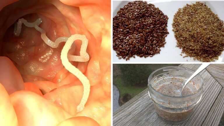 5 naturalnych sposobów na pozbycie się Darmparasiten raz na zawsze!